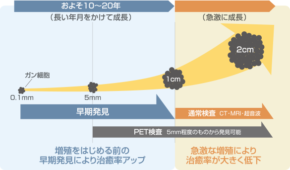早期発見の重要性