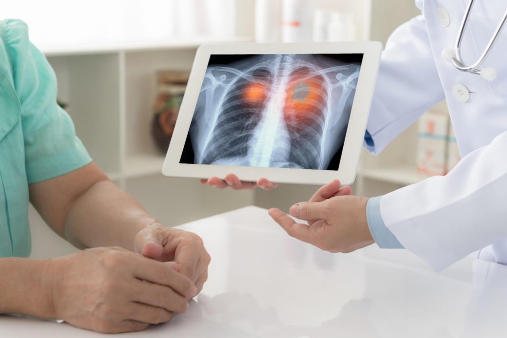 肺がんの検診費用や、検診の内容、検診で使用する機器などについて詳しく解説